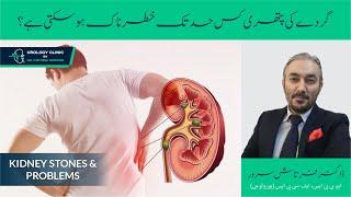 Kidney Stones & Problems | گردے کی پتھری کے خطرناک اثرات | By Dr. Fartash Sarwar | Urdu/Hindi