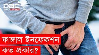 ফাঙ্গাল ইনফেকশন কী? কেন হয়?