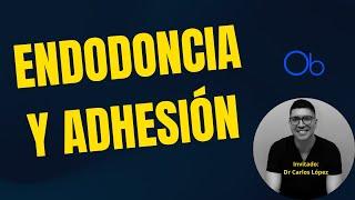 Platicando sobre ENDODONCIA Y ADHESIÓN  con Dr Carlos López