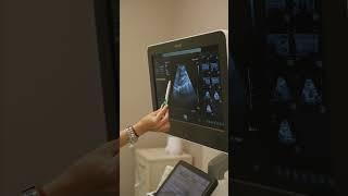 Эксперимент по похудению с Кормим Правильно!