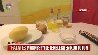 "Patates maskesi"yle lekelerden kurtulun