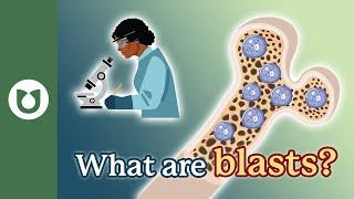 What are blasts and how are they measured? #AML