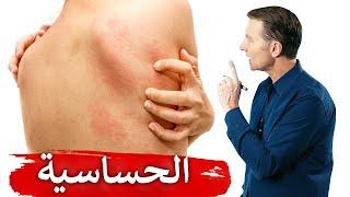 الحساسية | ما هو الهستامين وكيف نقلله للتخلص من حساسية الأنف والجلد