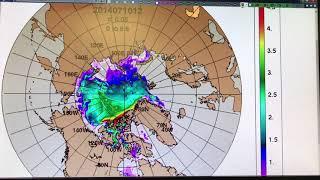 Patterns of Arctic Sea-Ice Loss: Melt versus Export