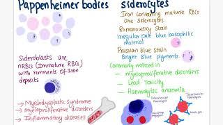 Pappenheimer bodies