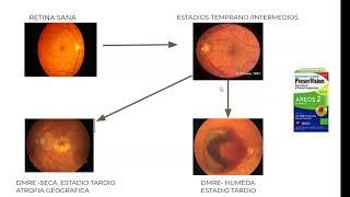Atrofia geográfica. Clasificación por OCT. Dr Nicolas Blanco
