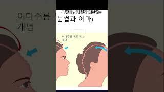 내시경 리프팅 - 제이제이성형외과 #shorts