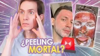 Se hizo un PEELING y MURI0 - PEELING DE FENOL - ¿Son riesgosos los peelings? - Chisme Dermatológico