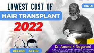 Lowest Cost  of Hair Transplant in Kolkata 2022 | Best Hair Transplant Clinic | Dr. Nagwani - Hindi