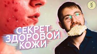 Как связаны АКНЕ и ПИТАНИЕ?