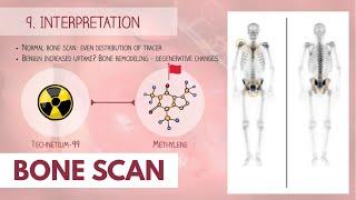 Bone Scan Procedure | Dr. Paulien Moyaert