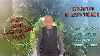 Результат по продукту Тяньши. Ример Давид Александрович, 64 года. Был туберкулезный спондилит