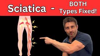 The Secret To Fixing BOTH Types Of Sciatica - NO MORE PAIN!