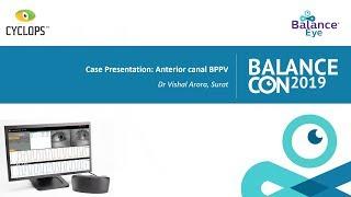 Case presentation: Anterior canal BPPV