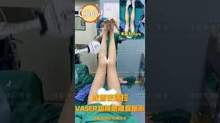 中国大陆成都莱瑞拉威塑吸脂医院丨VASER全腿美雕即刻对比，超模大长腿即刻拥有！