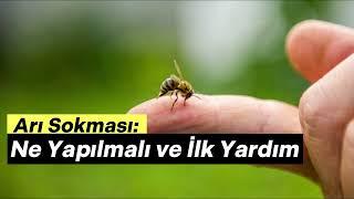 Arı Sokması: Ne Yapılmalı ve İlk Yardım