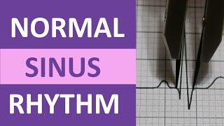 Normal Sinus Rhythm Nursing Made Easy on ECG/EKG Heart Interpretation