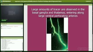 Webinar: Application of the Igennus CFS/ME protocol in The Perrin Technique