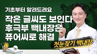 백내장 56세 후극부 백내장 퓨어씨 (수술 후 골프공 날아가는 것이 잘 보임)