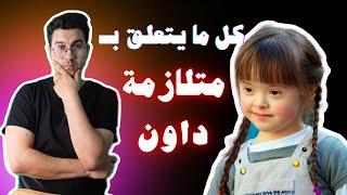 متلازمة داون | الأعرض والأسباب | وطرق العلاج | العمر المتوقع للطفل المصاب Down Syndrome