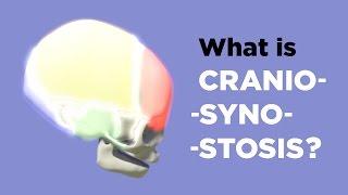 What is Craniosynostosis?