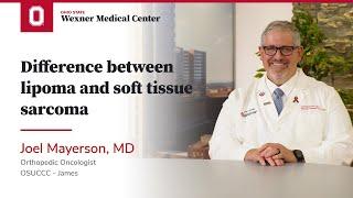 Difference between lipoma and soft tissue sarcoma  | OSUCCC – James