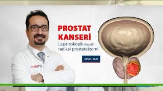 Prostat Kanseri Ameliyatı Hazırlığı - Prof.Dr. Ayhan Karaköse