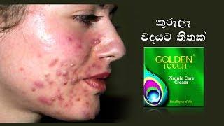 Acne Treatment 100% Successful - 100% Natural