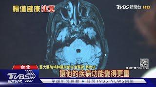 腸道健康與"疾病"有關...醫師警告這件事...｜十點不一樣 20210123