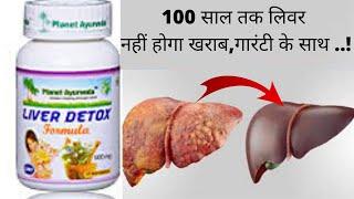 Planet Ayurveda Liver Detox Formula | Complete Liver Protective & Detoxification Formula | Review |