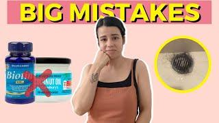 5 Hair Loss Mistakes I've Made (and you are too) | Female Hair Loss