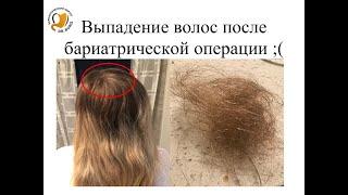 Выпадение волос после бариатрической операции;(
