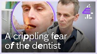 Do You Fear Going To The Dentist? | Embarrassing Bodies | E4