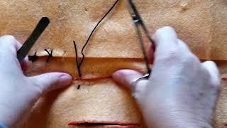 Suture Pattern: Vertical Mattress