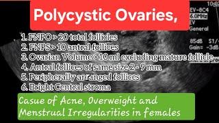 Polycystic Ovaries (PCO vs PCOS), Female Infertility #medical #health #pregnancy #ultrasound