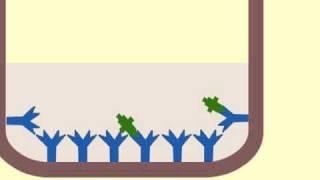 Enzyme immunoassay (EIA) to detect antigens - Multi-Lingual Captions