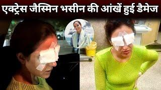 Jasmine Bhasin's eyes got damaged due to contact lenses | Jasmine Bhasin Latest Health Update News