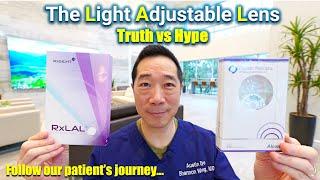 Light Adjustable Lens (LAL). Truth v Hype. Patient & surgeon perspective.  PanOptix/LAL combination.