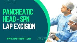 SPN Head of pancreas | Enucleation | Pancreatic SPT | Cystic pancreatic tumours | Dr Keyur Bhatt