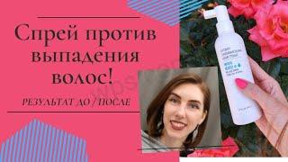 Спрей против выпадения волос отзывы, лучшее средство от выпадения волос, Атоми корейская косметика