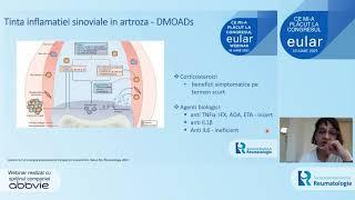 Eular 16 iunie 2021 - Artroza si durerea - Corina Delia Mogosan