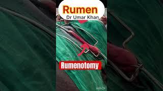 Rumenotomy l dr Umar Khan