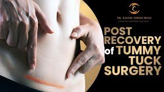 Tummy Tuck Recovery: What to Expect, Timeline, Tips and More
