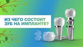  Из чего состоит зуб на импланте (имплант+абатмент+коронка)