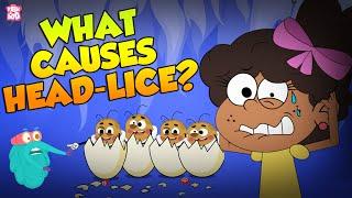 What Causes Head Lice? | Treatment For Head Lice | The Dr Binocs Show | Peekaboo Kidz