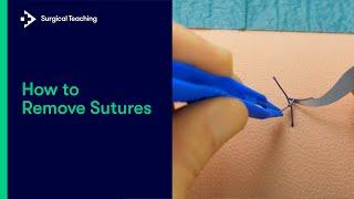 How to Remove Sutures