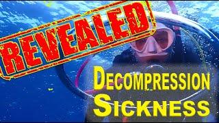 Decompression Sickness DCS Revealed with Professor Simon Mitchell - A Complete Deep Dive