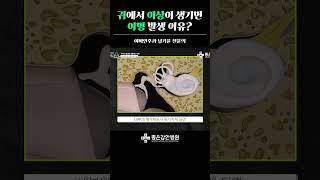귀에서 이상이 생기면 이명 발생하는 이유?