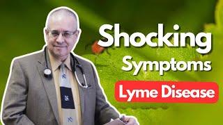 Top 2 Surprising Lyme Disease Symptoms & Manifestations You Didn't Know