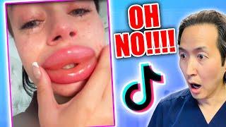 Plastic Surgeon Reacts to UNHINGED DIY Plastic Surgery TikToks!